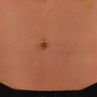 Lado derecho del abdomen inflamado